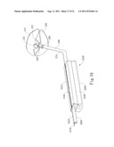 AUTOMATED NEGATIVE PRESSURE ORAL APPARATUS diagram and image