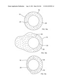 Use of Micro-Electro-Mechanical Systems (MEMS) in Well Treatments diagram and image