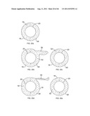 Use of Micro-Electro-Mechanical Systems (MEMS) in Well Treatments diagram and image