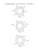 Use of Micro-Electro-Mechanical Systems (MEMS) in Well Treatments diagram and image