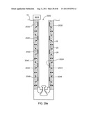 Use of Micro-Electro-Mechanical Systems (MEMS) in Well Treatments diagram and image