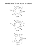 Use of Micro-Electro-Mechanical Systems (MEMS) in Well Treatments diagram and image