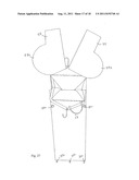 Garment Bag System diagram and image