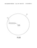 System and method for the manufacture of surgical blades diagram and image