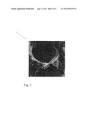 IMAGE ANALYSIS diagram and image