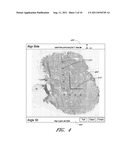 SYSTEM AND METHOD FOR LASER DISSECTION diagram and image