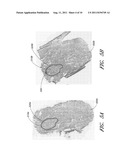 SYSTEM AND METHOD FOR LASER DISSECTION diagram and image