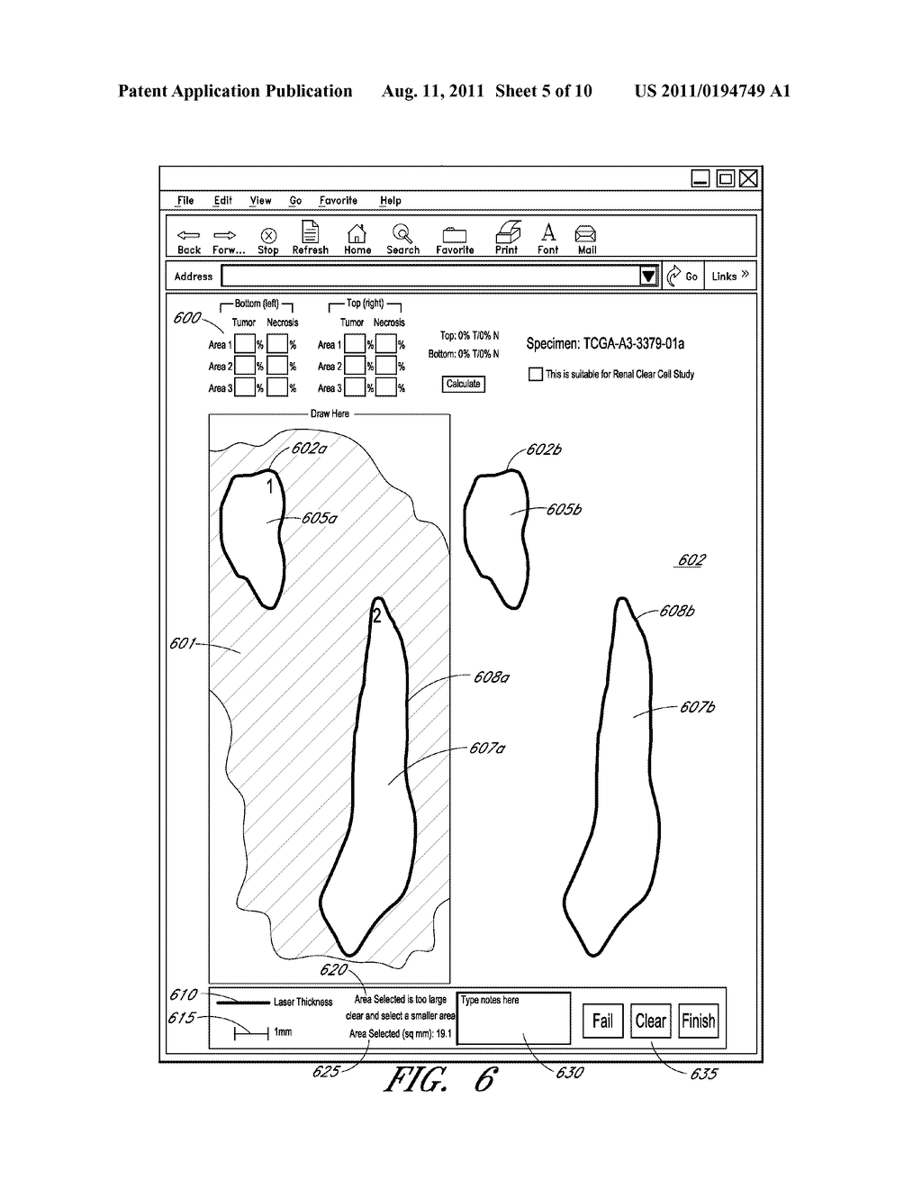 SYSTEM AND METHOD FOR LASER DISSECTION - diagram, schematic, and image 06