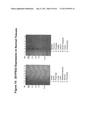 NUCLEIC ACIDS AND CORRESPONDING PROTEINS ENTITLED 251P5G2 USEFUL IN     TREATMENT AND DETECTION OF CANCER diagram and image