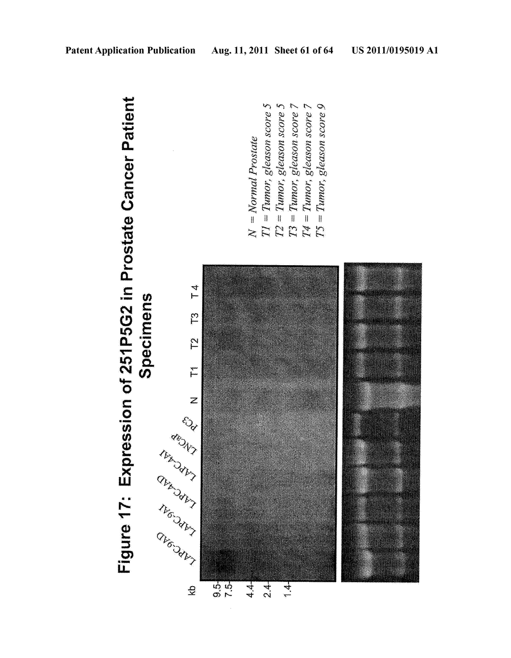 NUCLEIC ACIDS AND CORRESPONDING PROTEINS ENTITLED 251P5G2 USEFUL IN     TREATMENT AND DETECTION OF CANCER - diagram, schematic, and image 62