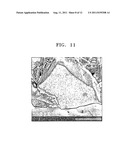 Secondary particle and lithium battery including secondary particle diagram and image