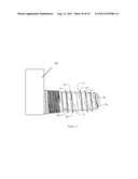 Self-Clearing Self-Cutting Implant diagram and image