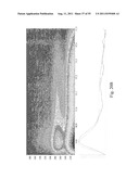 SYSTEMS AND METHODS FOR DIAGNOSING CANCER diagram and image