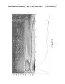 SYSTEMS AND METHODS FOR DIAGNOSING CANCER diagram and image