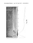 SYSTEMS AND METHODS FOR DIAGNOSING PARASITE INFECTIONS diagram and image