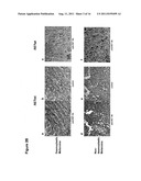 UTILITY OF RET MUTANT IN DIAGNOSIS AND TREATMENT OF MELANOMA diagram and image