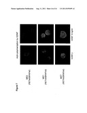 UTILITY OF RET MUTANT IN DIAGNOSIS AND TREATMENT OF MELANOMA diagram and image