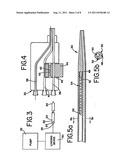 METHODS AND APPARATUS EMPLOYING IONIZING RADIATION FOR TREATMENT OF     CARDIAC ARRHYTHMIA diagram and image