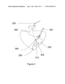 MAGNETICALLY SENSITIVE DRUG CARRIERS AND DELIVERY DEVICES diagram and image