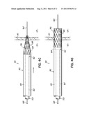 CANNULA LINED WITH TISSUE IN-GROWTH MATERIAL AND METHOD OF USING THE SAME diagram and image