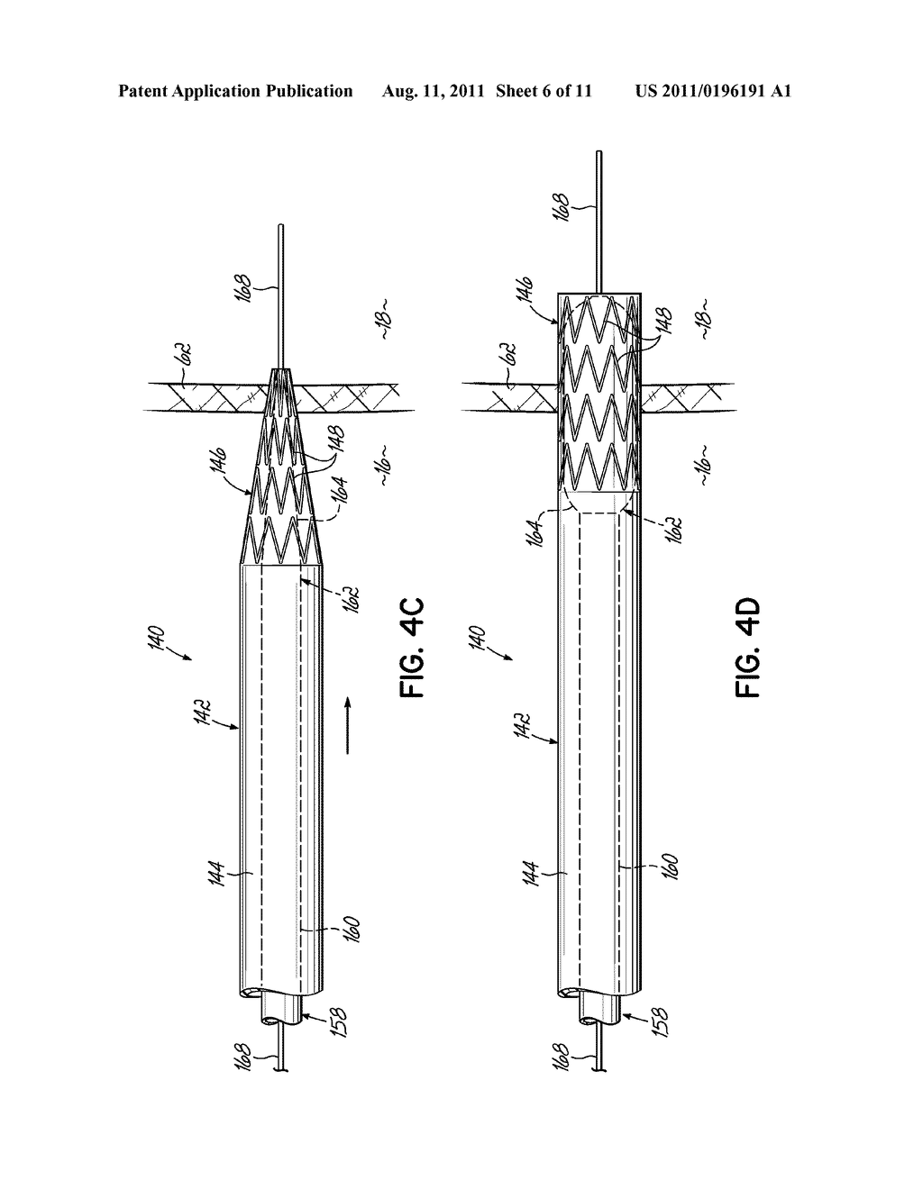 CANNULA LINED WITH TISSUE IN-GROWTH MATERIAL AND METHOD OF USING THE SAME - diagram, schematic, and image 07