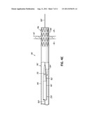 CANNULA LINED WITH TISSUE IN-GROWTH MATERIAL AND METHOD OF USING THE SAME diagram and image