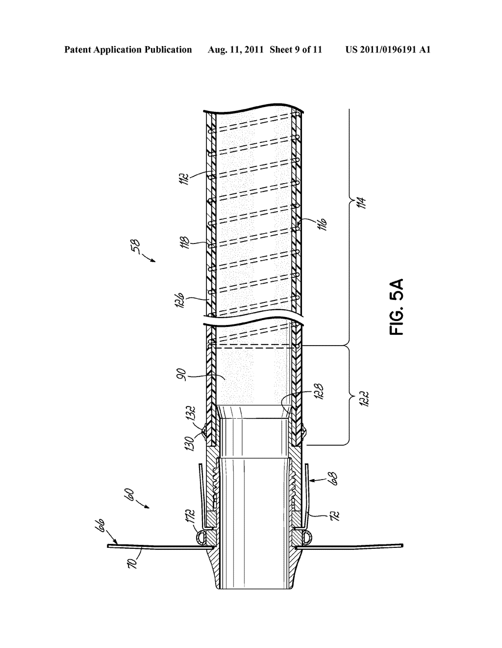 CANNULA LINED WITH TISSUE IN-GROWTH MATERIAL AND METHOD OF USING THE SAME - diagram, schematic, and image 10