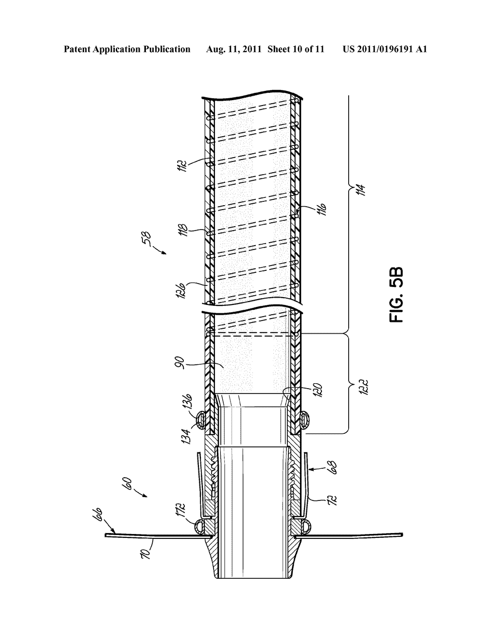 CANNULA LINED WITH TISSUE IN-GROWTH MATERIAL AND METHOD OF USING THE SAME - diagram, schematic, and image 11