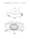 IMPLANTABLE SUBCUTANEOUS ACCESS PORT diagram and image