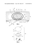 IMPLANTABLE SUBCUTANEOUS ACCESS PORT diagram and image