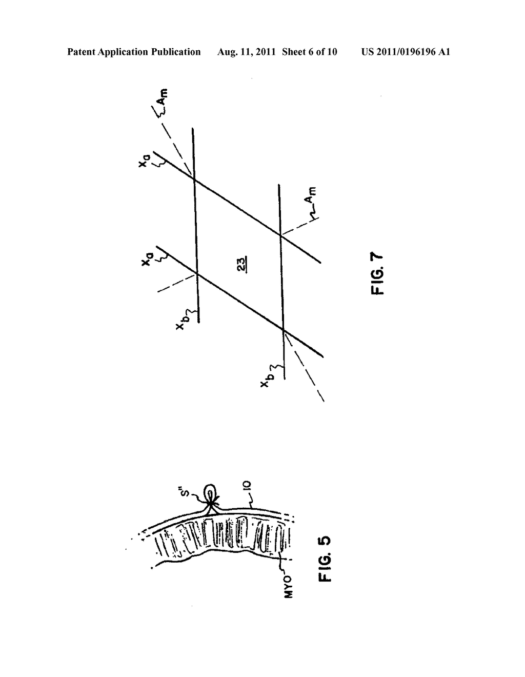 CARDIAC DISEASE TREATMENT AND DEVICE - diagram, schematic, and image 07