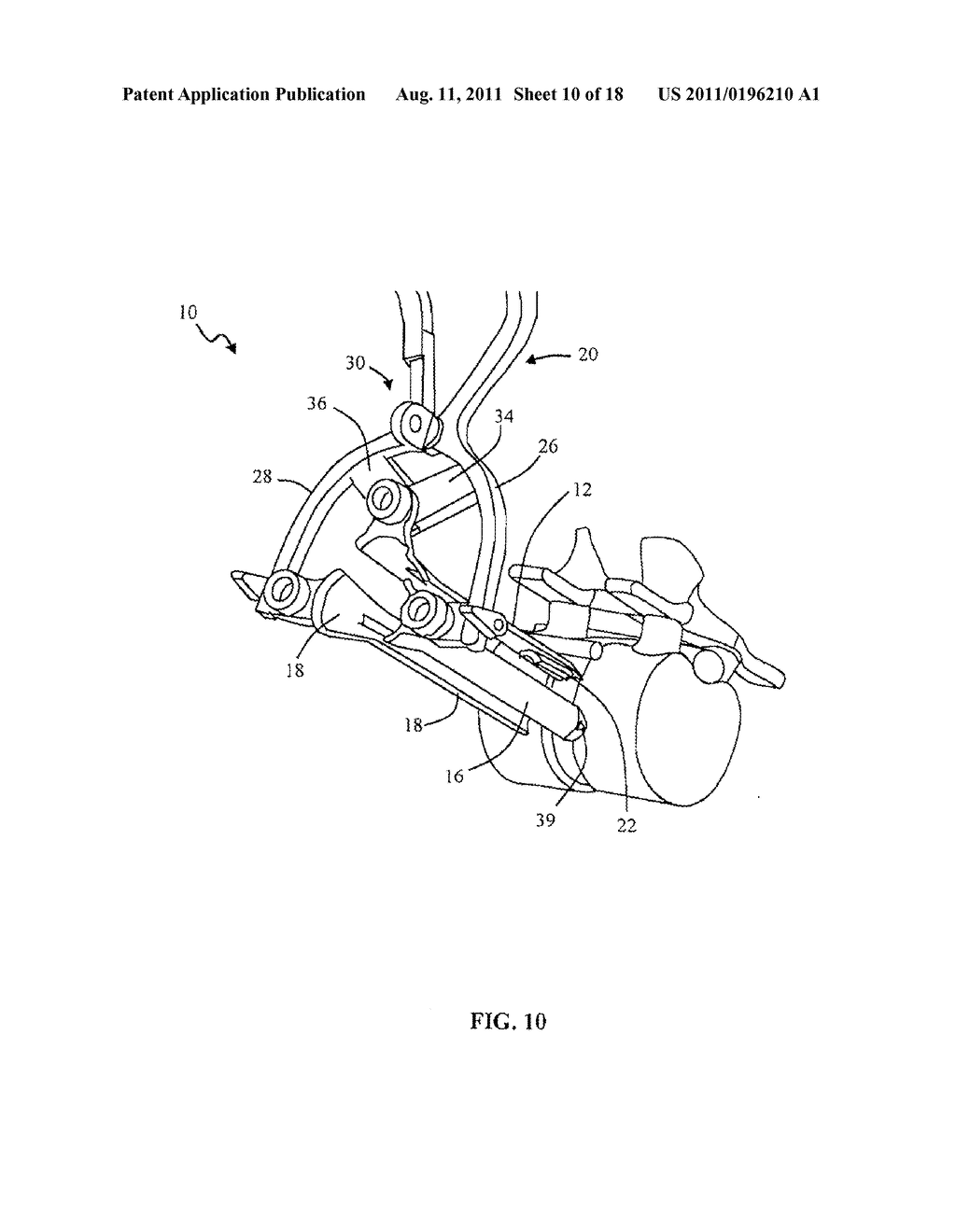 SURGICAL ACCESS SYSTEM AND RELATED METHODS - diagram, schematic, and image 11