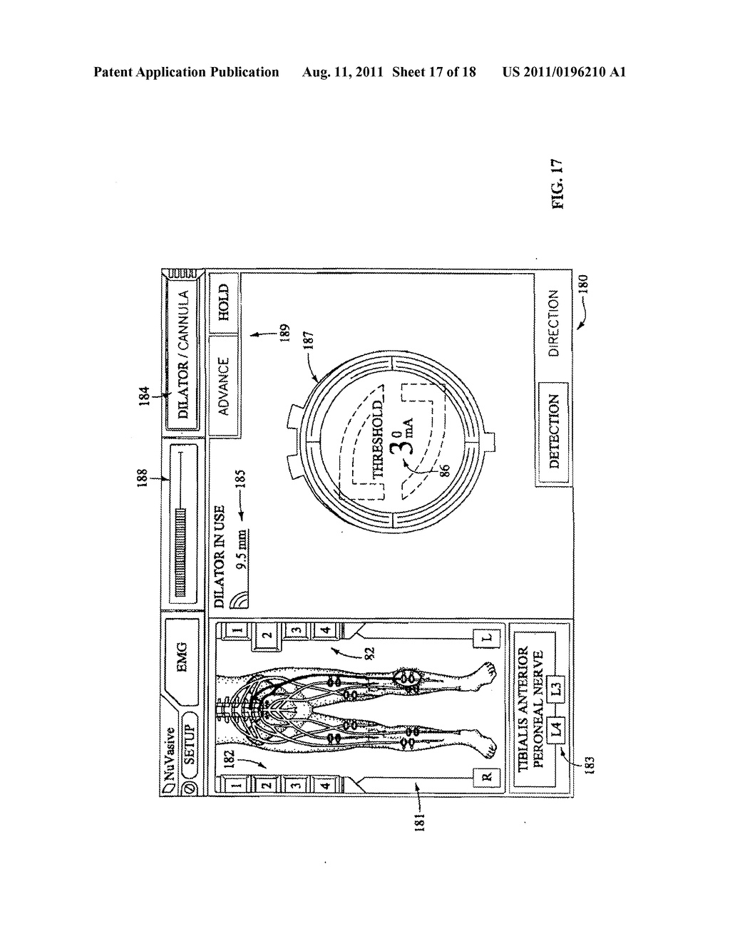 SURGICAL ACCESS SYSTEM AND RELATED METHODS - diagram, schematic, and image 18