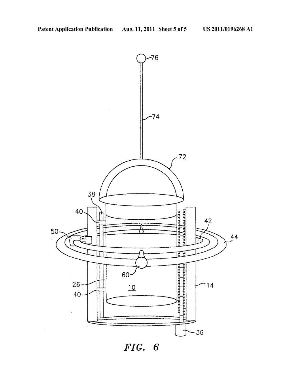 Precision Guidance of Extracorporeal Shock Waves - diagram, schematic, and image 06