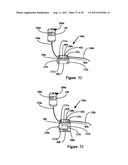 Method and Apparatus for Controlling An Infusion Pump or the Like diagram and image