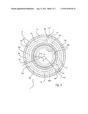 IMPLANT diagram and image