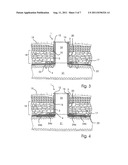 IMPLANT diagram and image