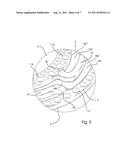 IMPLANT diagram and image