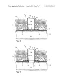 IMPLANT diagram and image