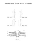 Absorbent Article with Containment Barrier diagram and image