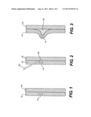 DEVICES AND METHODS FOR AGENT-ASSISTED MEDICAL PROCEDURES diagram and image