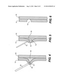 DEVICES AND METHODS FOR AGENT-ASSISTED MEDICAL PROCEDURES diagram and image