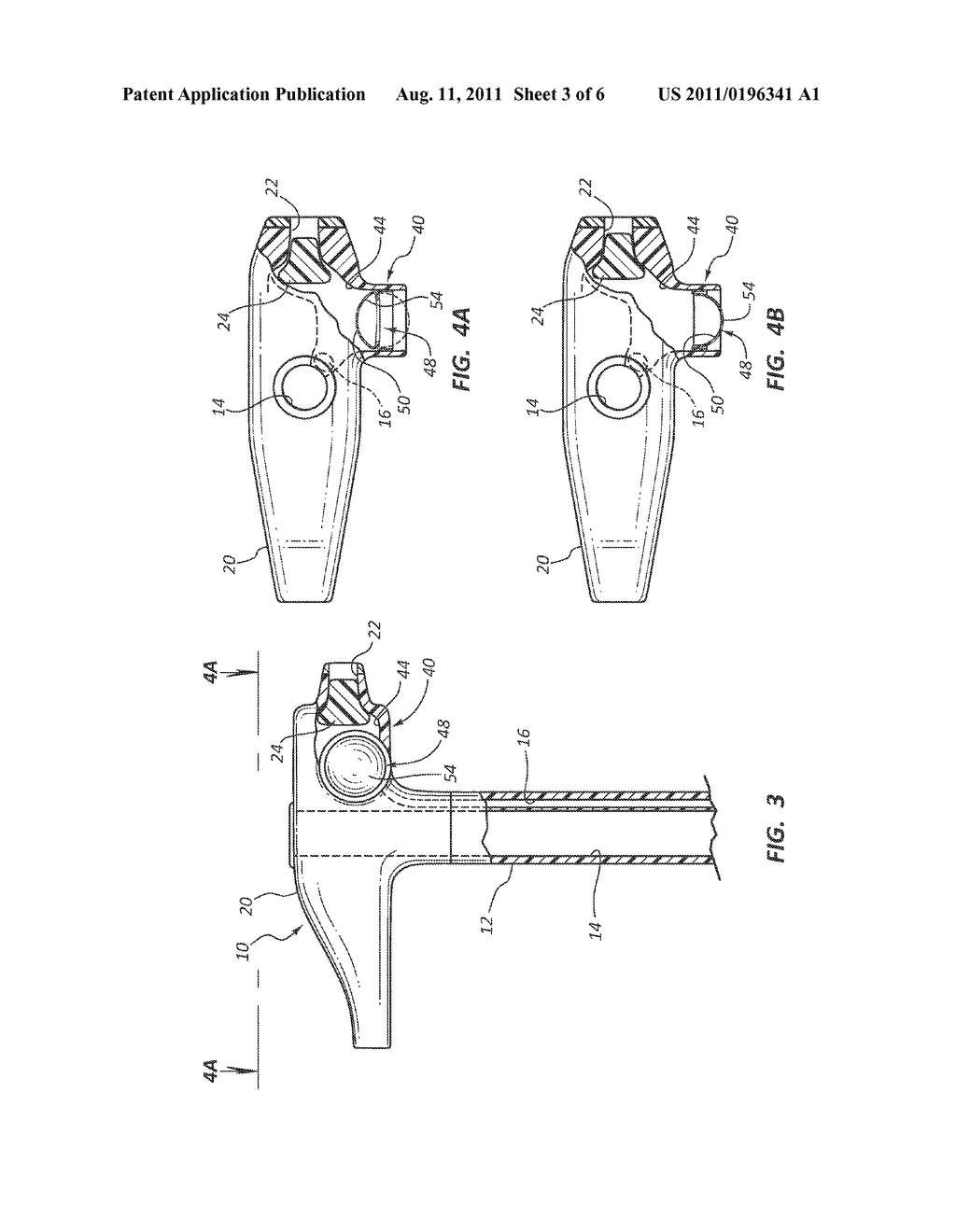 DEFLATION INDICATOR FOR A MEDICAL DEVICE BOLSTER - diagram, schematic, and image 04