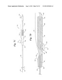 Single Operator Exchange Biliary Catheter diagram and image