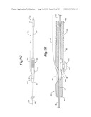 Single Operator Exchange Biliary Catheter diagram and image