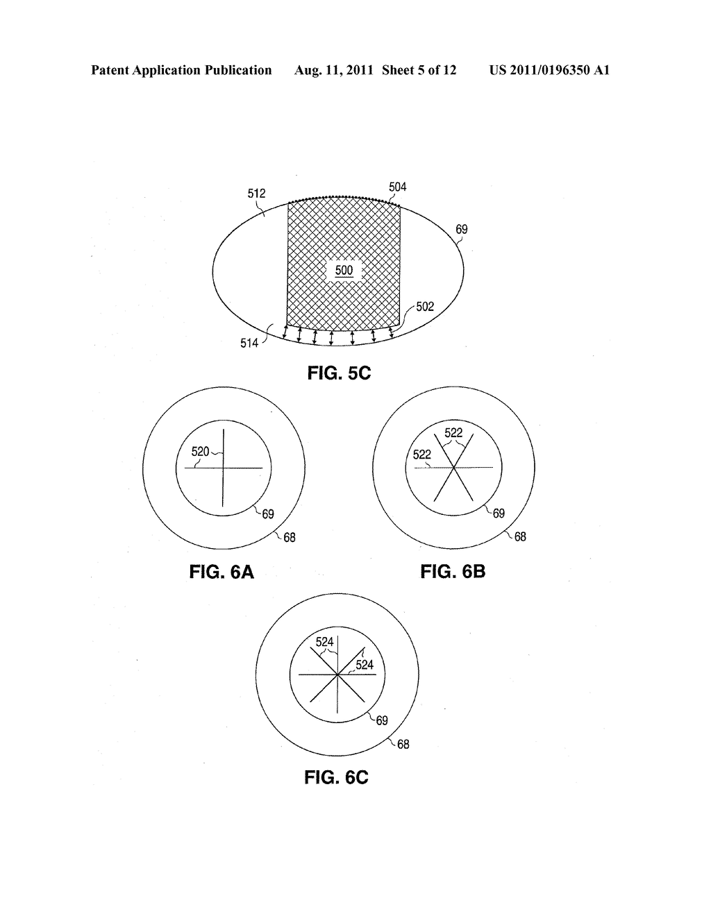 SYSTEM AND METHOD FOR PLASMA-MEDIATED MODIFICATION OF TISSUE - diagram, schematic, and image 06