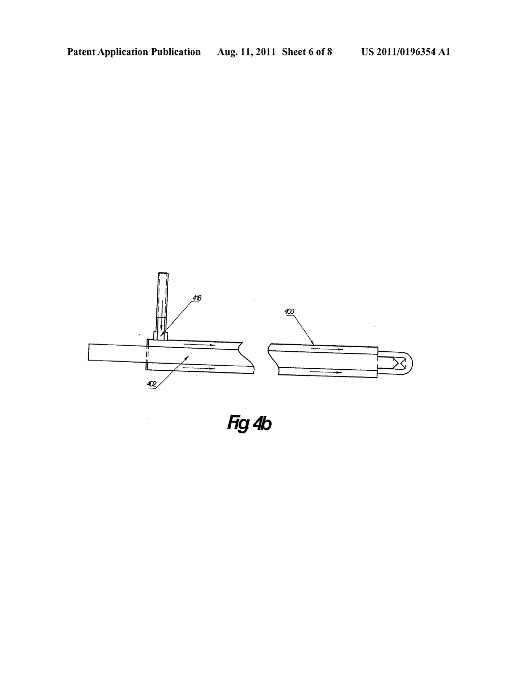 METHOD AND DEVICE FOR VASCULAR TREATMENT - diagram, schematic, and image 07