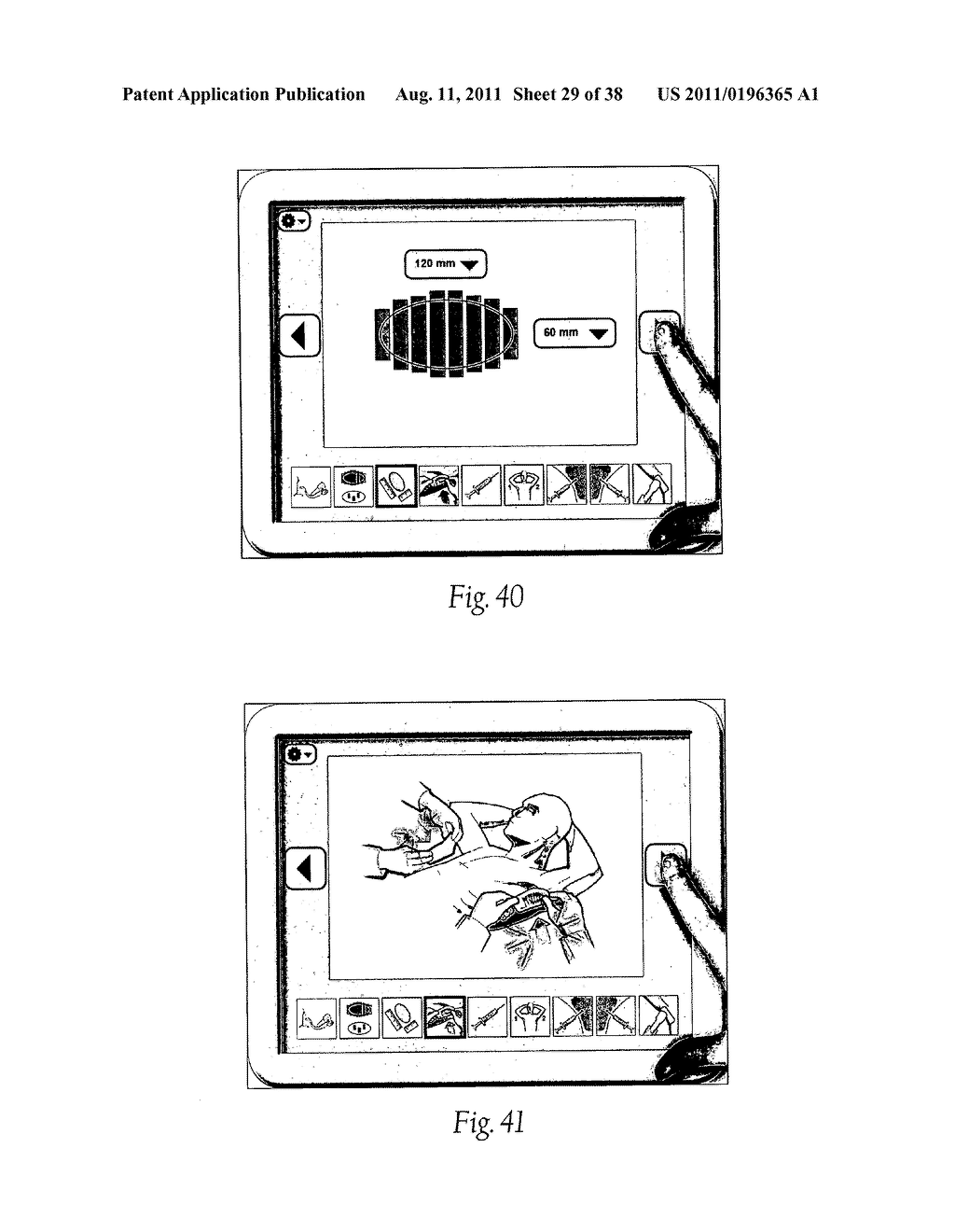 Systems, Apparatus, Methods, and Procedures for the Non-Invasive Treatment     of Tissue Using Microwave Energy - diagram, schematic, and image 30