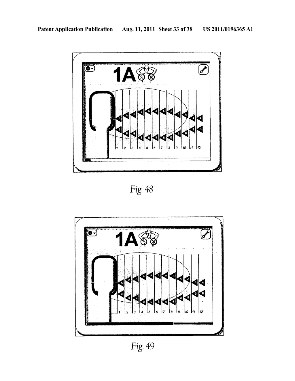 Systems, Apparatus, Methods, and Procedures for the Non-Invasive Treatment     of Tissue Using Microwave Energy - diagram, schematic, and image 34