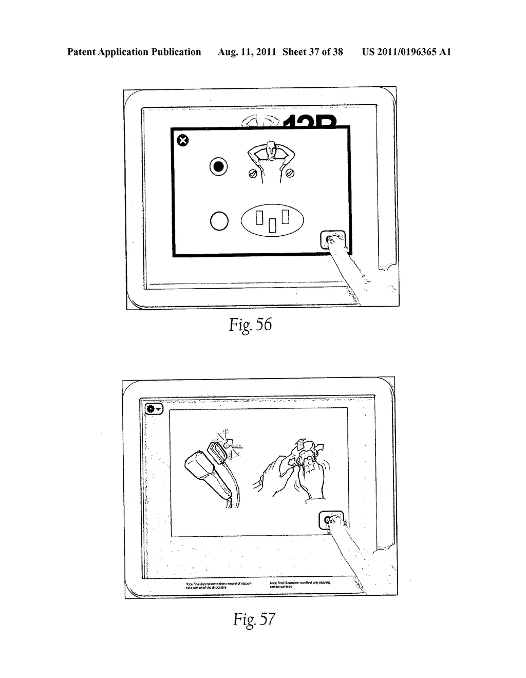 Systems, Apparatus, Methods, and Procedures for the Non-Invasive Treatment     of Tissue Using Microwave Energy - diagram, schematic, and image 38